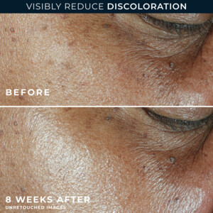 RoC Multi Correxion Even Tone Lift Daily Moist. Spf30 - 23.49 euro