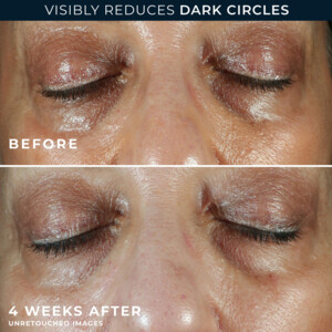 RoC Multi Correxion Even Tone + Lift Eye Cream - 18.25 euro