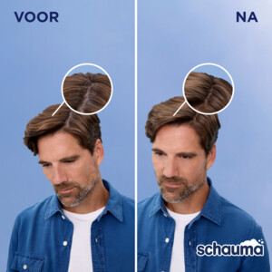 Schauma Shampoo Anti-Roos - 2.49 euro