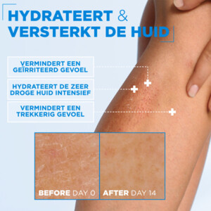 Mixa Ceramide Protect Hydraterende Crème - 9.89 euro