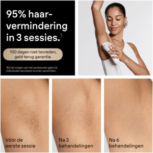 Braun IPL Silk-expert Pro 5 PL5234 - 539.99 euro