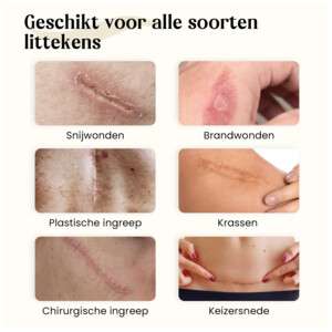 Dermatix Siliconen Gel - 25.95 euro