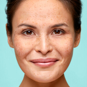 2x Biodermal Gelcrème Vette & Gemengde Huid - 49.98 euro