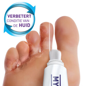 2x Mycosan Behandelset Gel Voetschimmel - 20.96 euro
