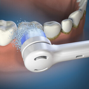Waterpik Opzetborstel Oscillate OTRB-3EW - 22.15 euro