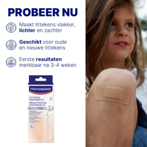 Hansaplast Finger Cohesive Zelfhechtende Vingerbandage - 5.49 euro