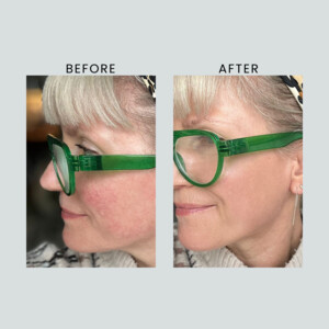 Altruist Zonnebrandcrème Anti-Roodheid en Pigmentatie SPF 50 - 13.25 euro